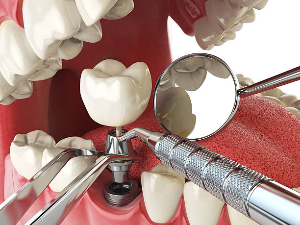 Best Dental Abscess Treatment in Newport, SC